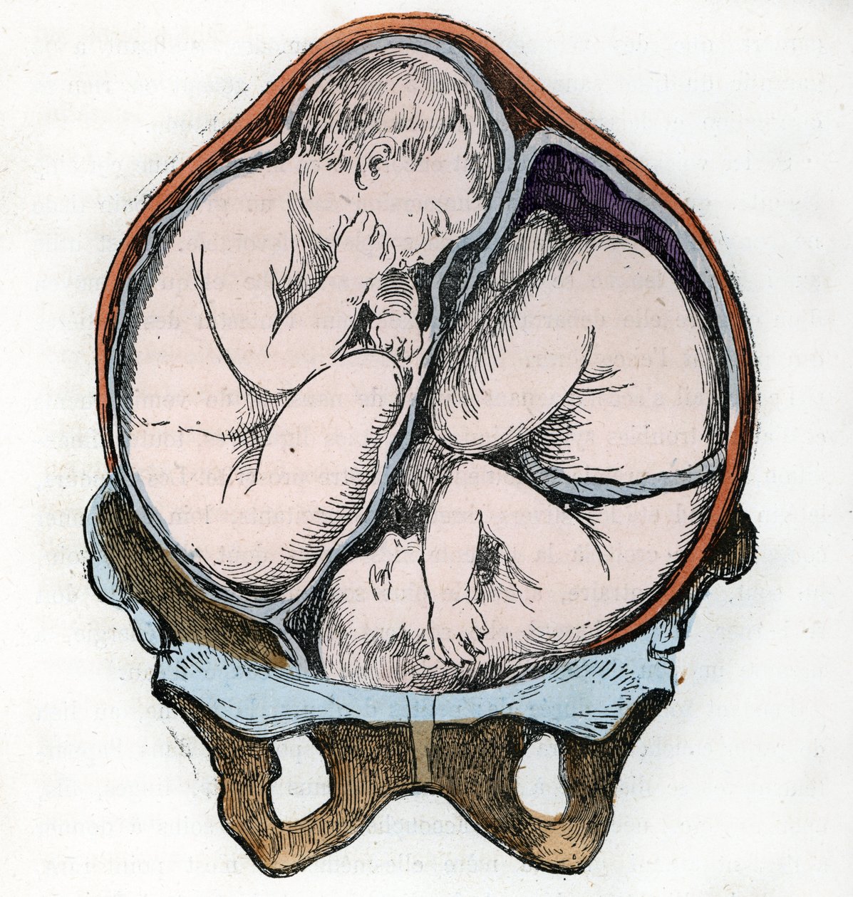 表现两个胎儿在妊娠期的良好姿势 1881 年伦加德《自然与人类》中的雕刻 私人收藏 作者 戴玛