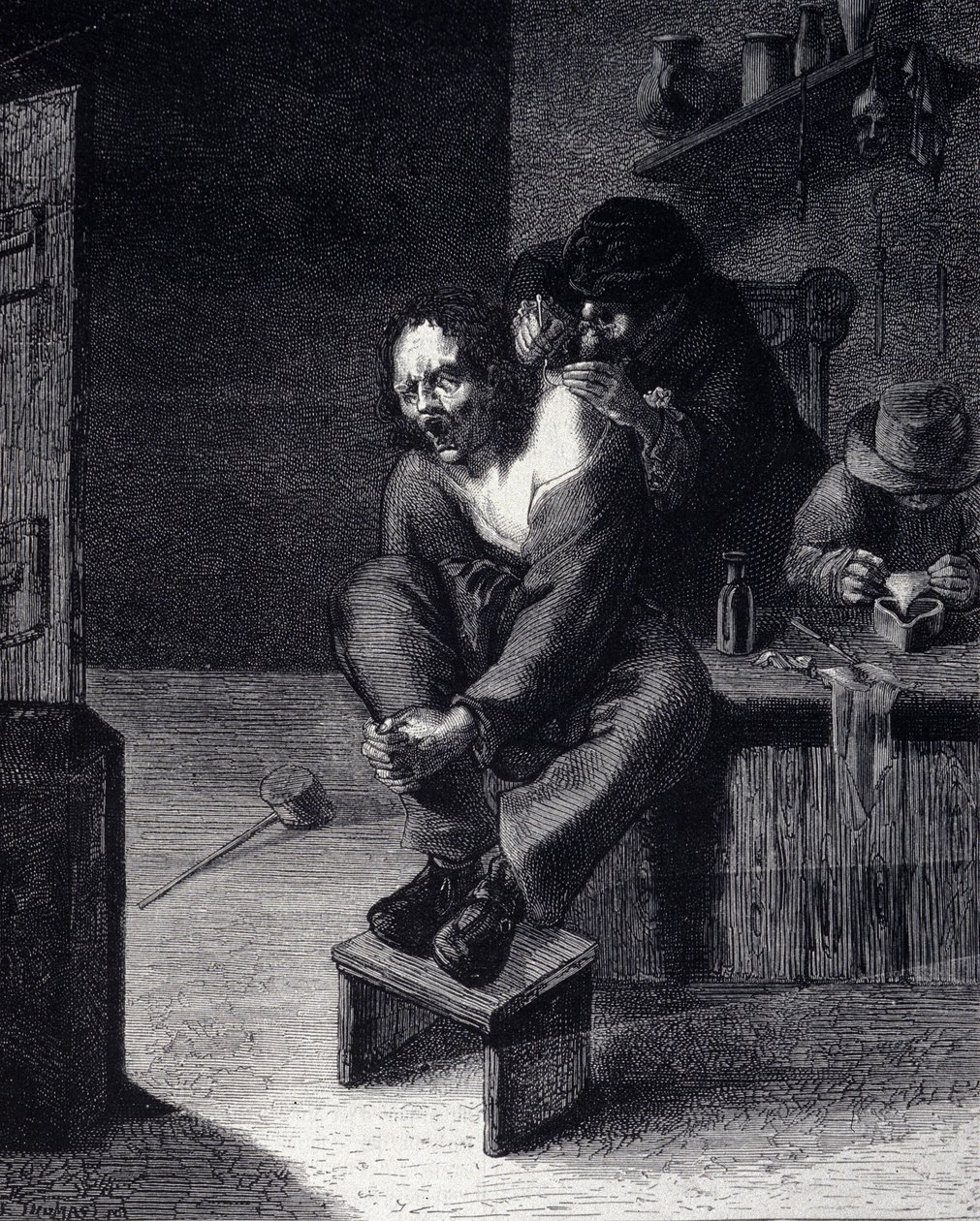 17 世纪阿德里安·布劳威尔 (Adrien Brauwer)（1608 年画）后的外科手术雕刻 作者 Adriaen（之后）Brouwer