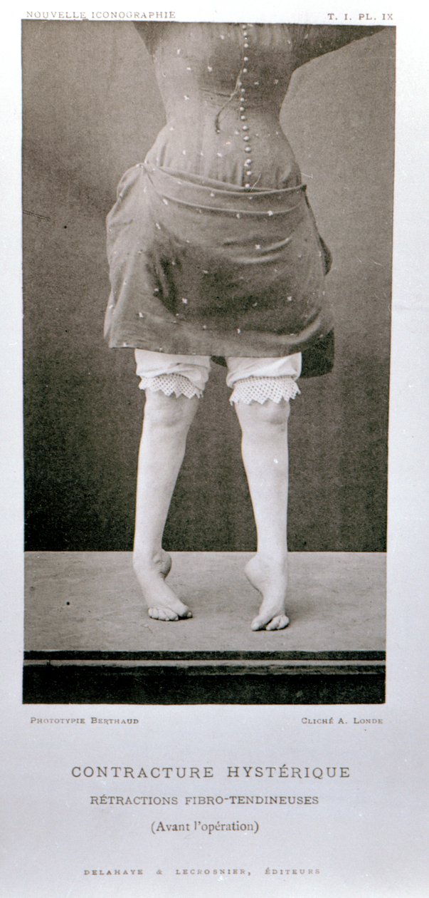 1889年在巴黎出版的Jean Martin Charcot教授（1825-93）的“新的Salpetriere图像”中的非自愿挛缩 作者 阿尔伯特·朗德