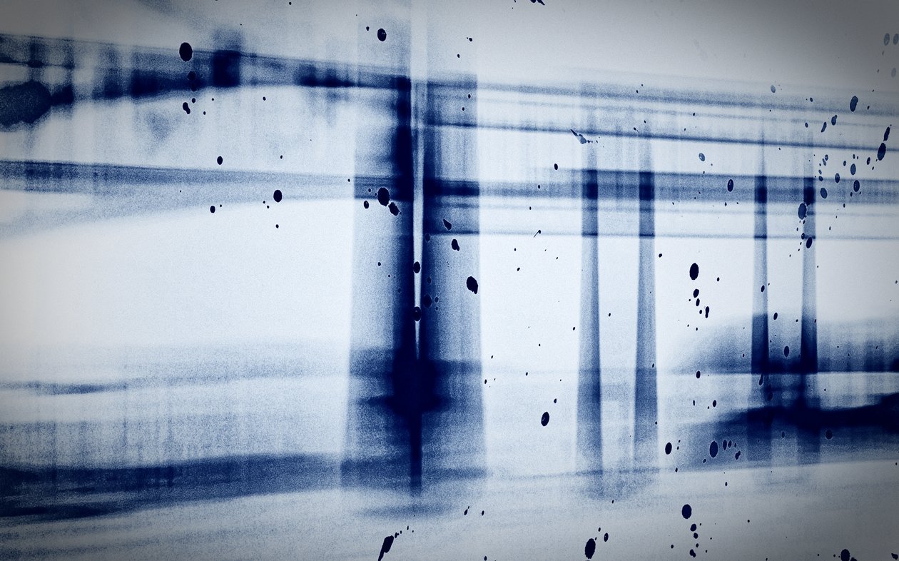 Snow (X-ray),2019,(photography) 作者 亚历克斯·卡明克