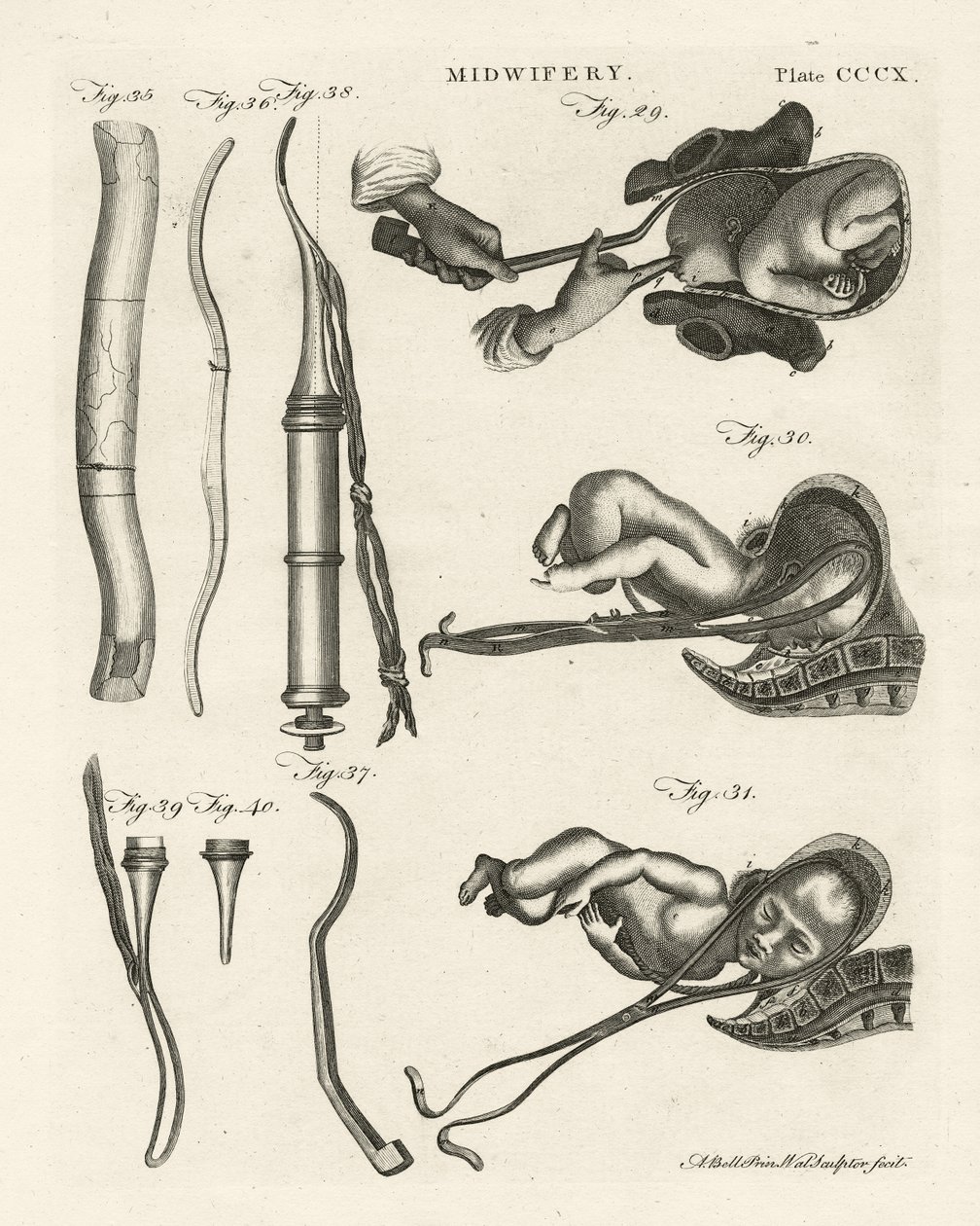 助产士，插图来自&39;Encyclopedia Britannica&39;，于1798年在爱丁堡出版（铜版画） 作者 亚历山大·贝尔