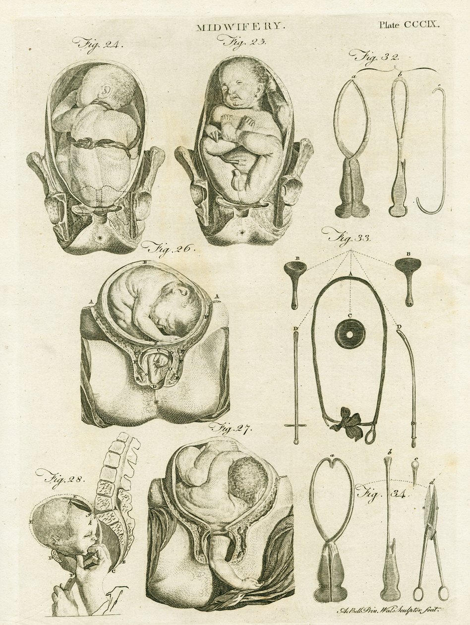助产士，插图来自&39;Encyclopedia Britannica&39;，于1798年在爱丁堡出版（铜版画） 作者 亚历山大·贝尔