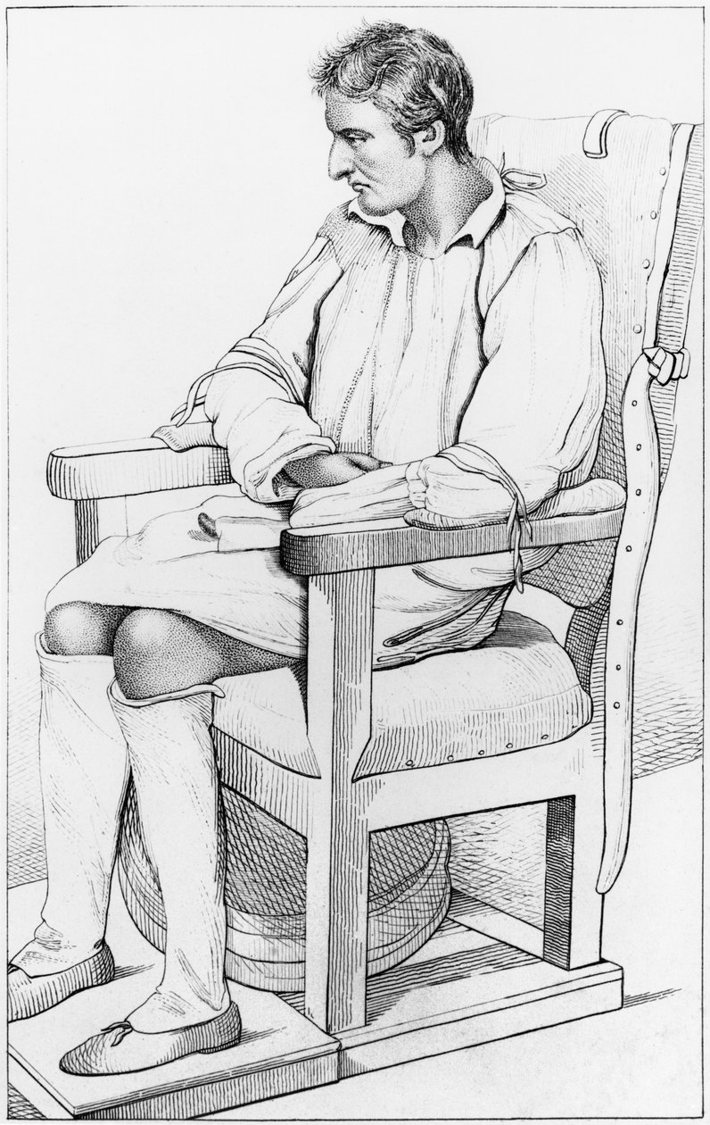 老年痴呆症，来自Etienne Esquirol（1772-1840）1838年的“精神疾病被认为是医疗，卫生和医疗法律” 作者 安布罗斯·塔迪厄（Ambroise Tardieu）
