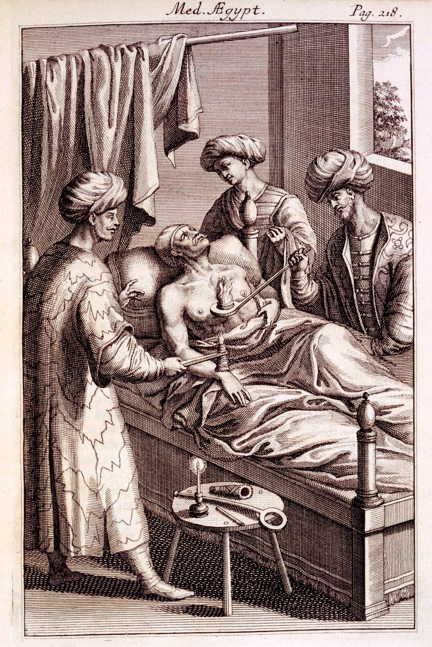 从Prospero Alpinus，1745年的Medicina Aegyptorum艾灸的插图 作者 美国学校