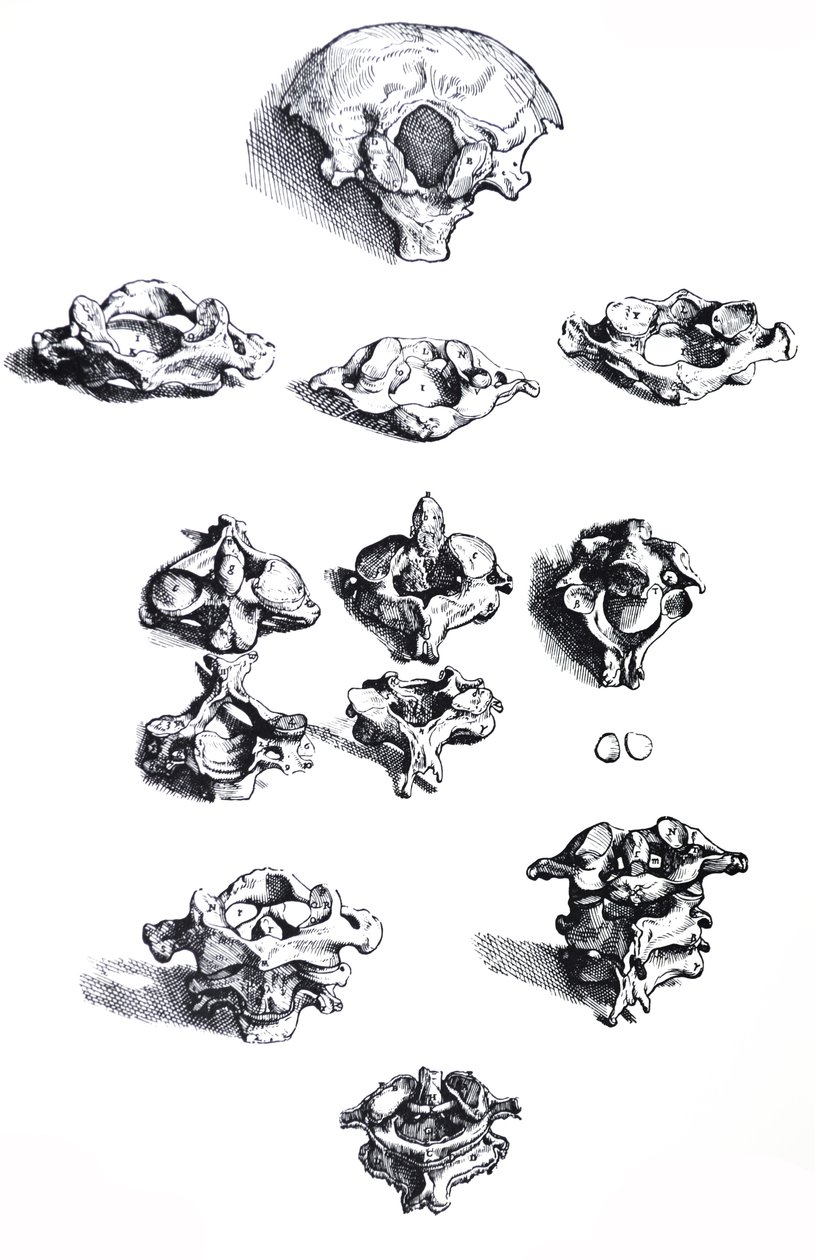 De Humani Corporis Fabrica第一本书中的版画 作者 安德鲁·维萨利厄斯