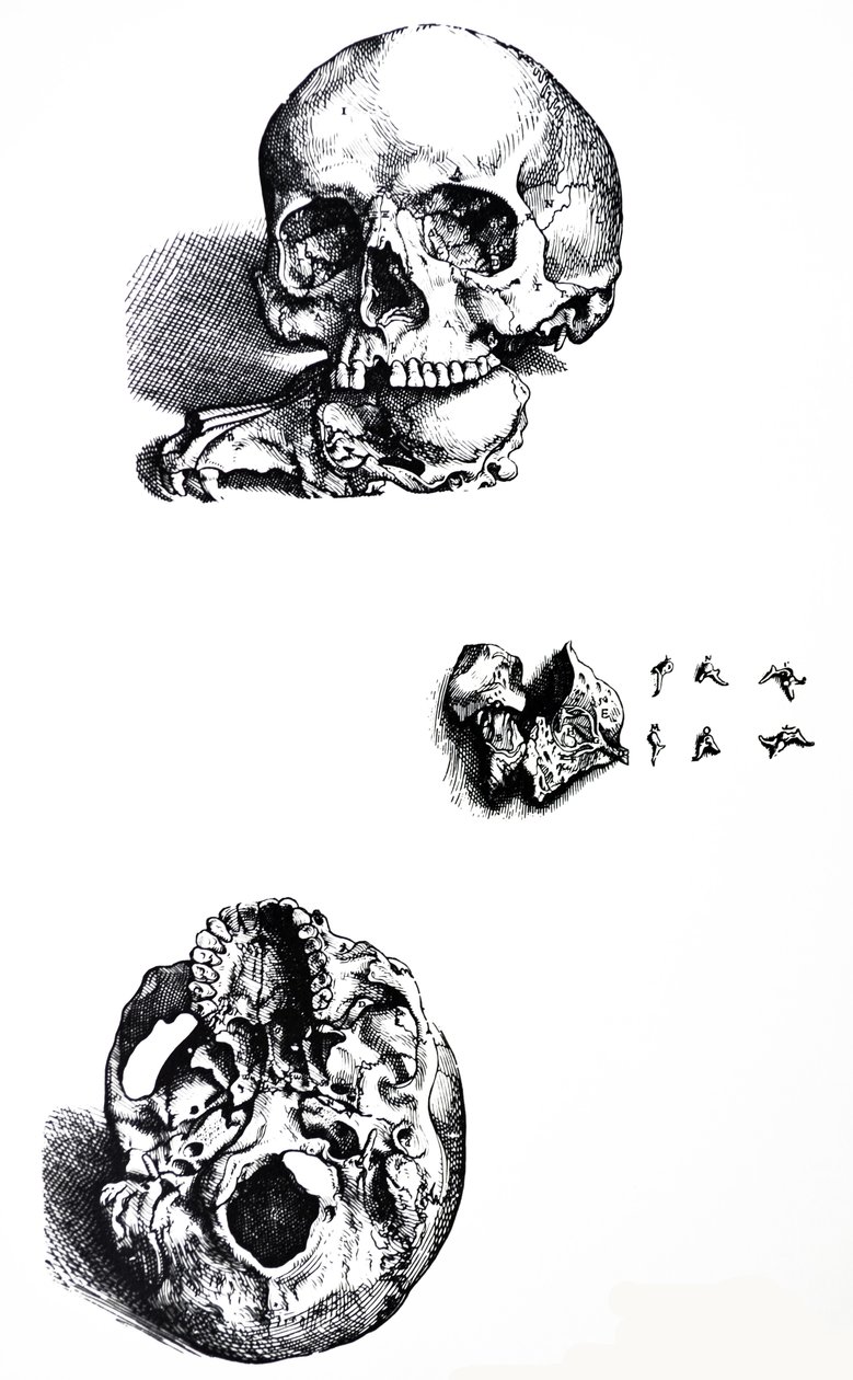 De Humani Corporis Fabrica第一本书中的版画 作者 安德鲁·维萨利厄斯