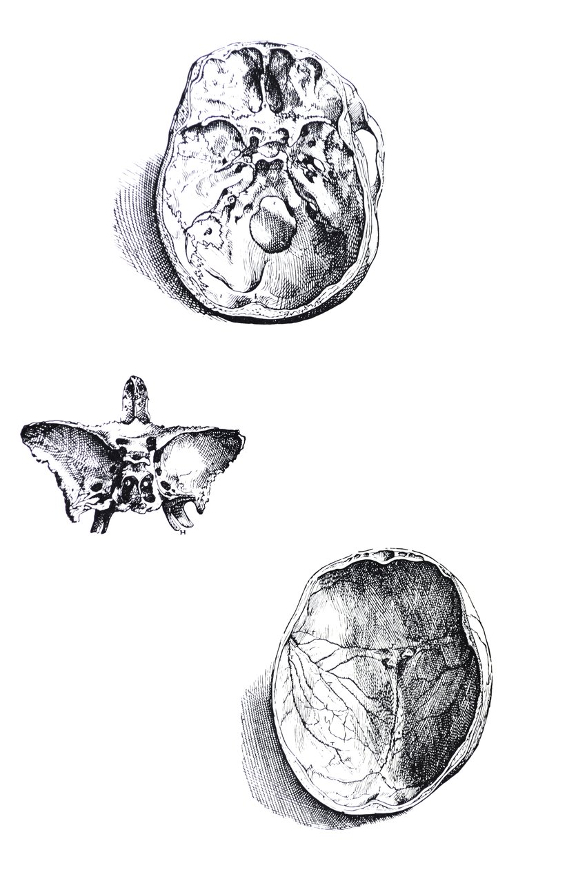 De Humani Corporis Fabrica第一本书中的版画 作者 安德鲁·维萨利厄斯