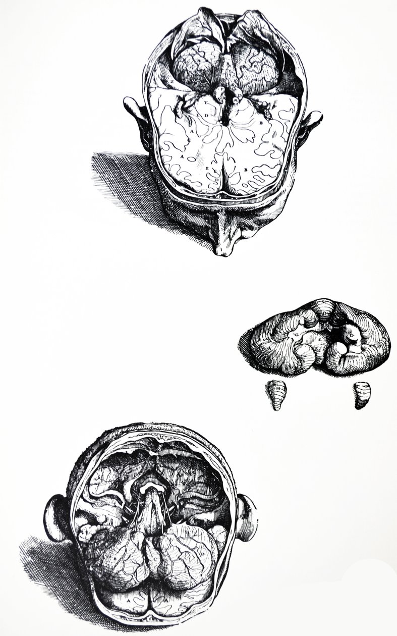 De Humani Corporis Fabrica第七册中的版画 作者 安德鲁·维萨利厄斯