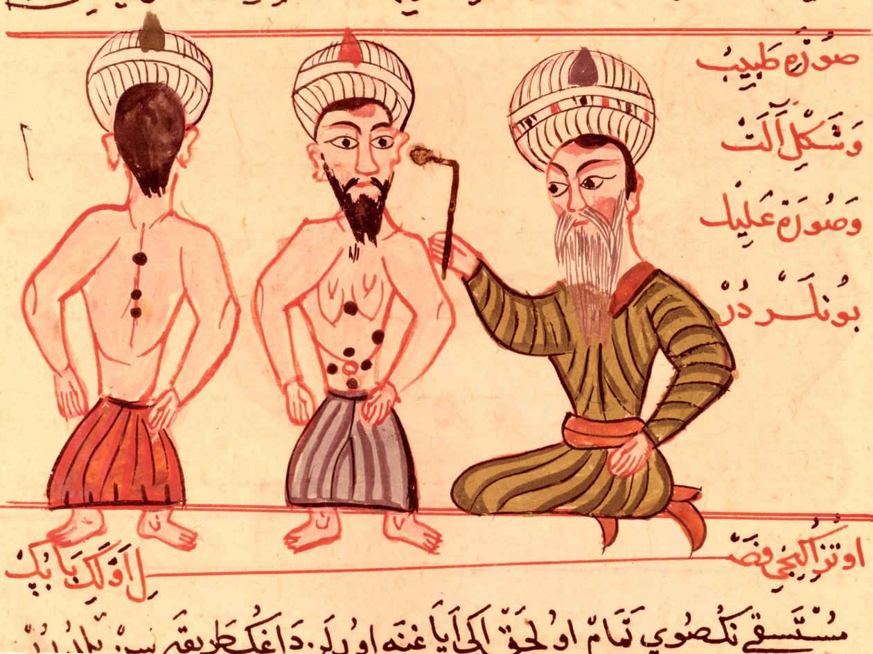 女士Sup Turc 693 fol.35灼烧术，1466年 作者 Charaf ed Din