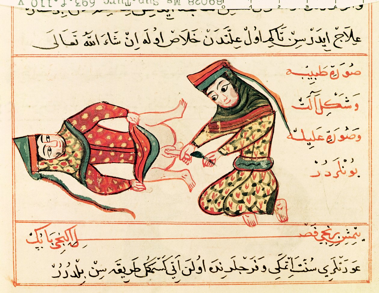 Sus Turc女士693 fol.110v助产士在雌雄同体手术，1466年 作者 Charaf ed Din
