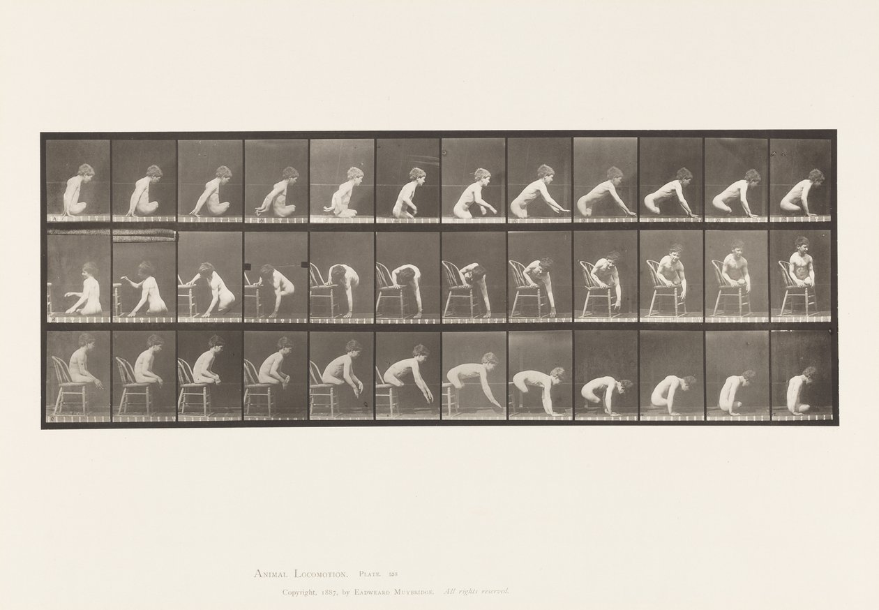 Plate 538. Double Amputation of Thighs; Boy; A, Moving Foward 作者 爱德沃德·迈布里奇