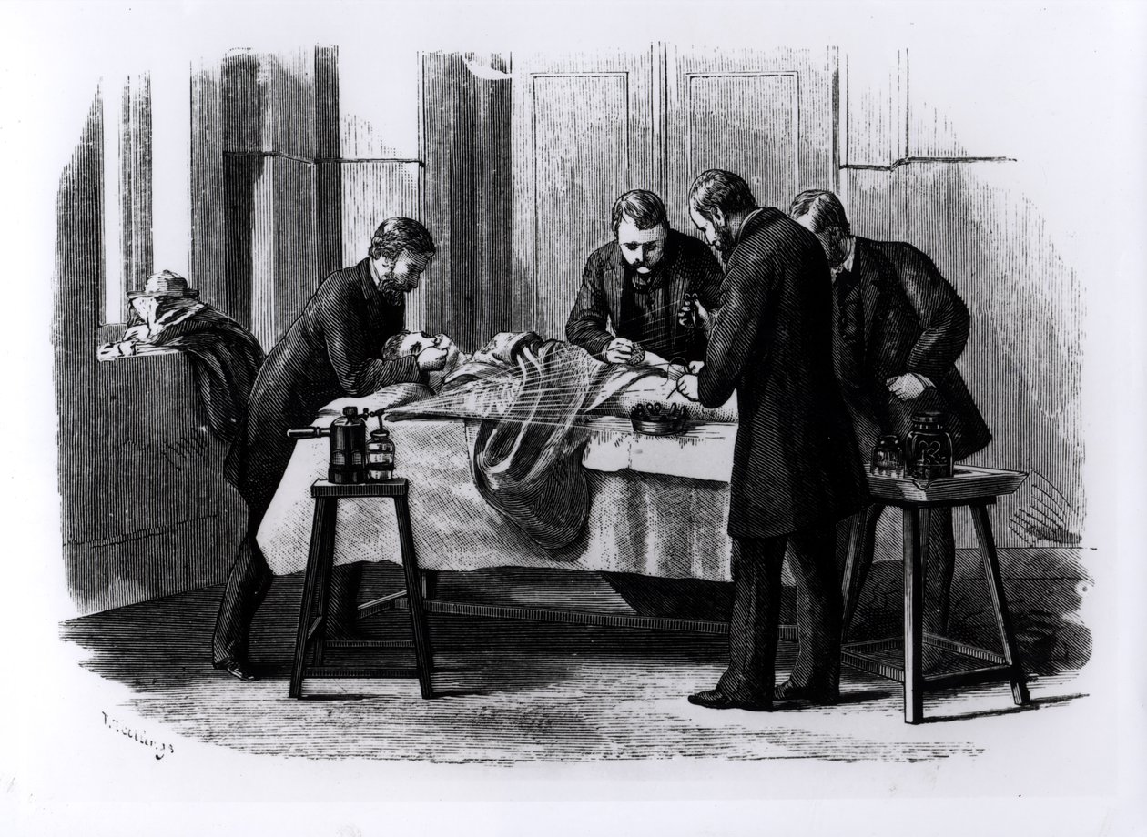 抗菌手术，1882年 作者 英语学校