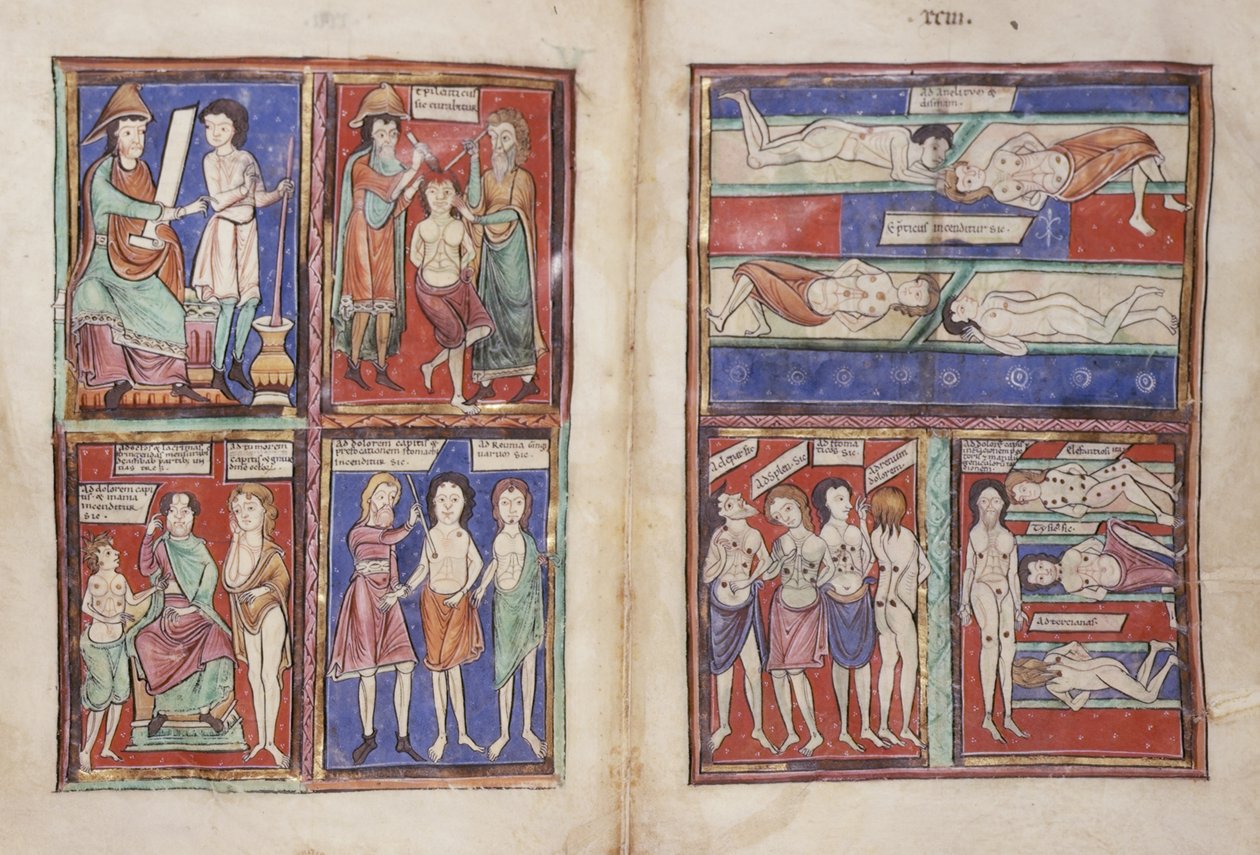 斯隆 1975 fol.91v-92 医疗场景 作者 英语学校