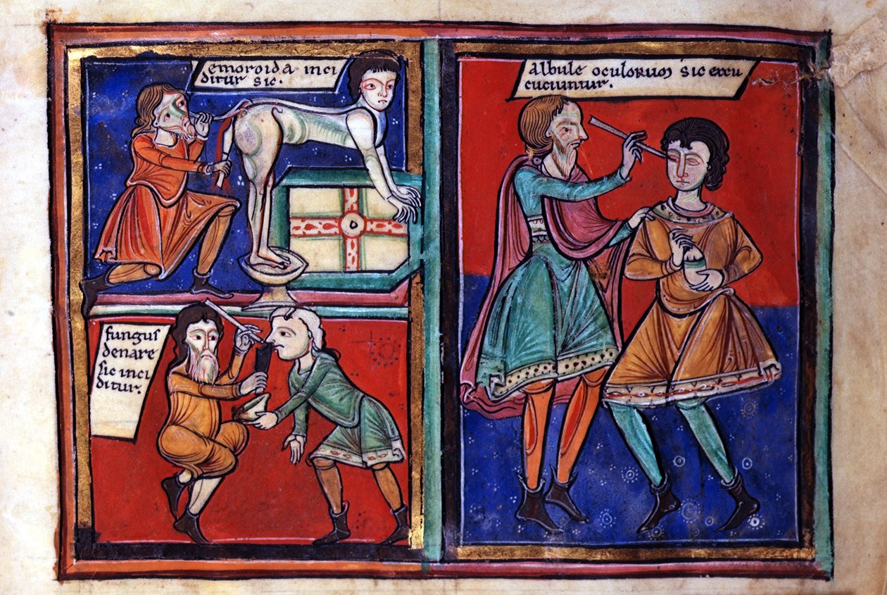 Sloane 女士 1975 fol.93 医疗手术 作者 英语学校