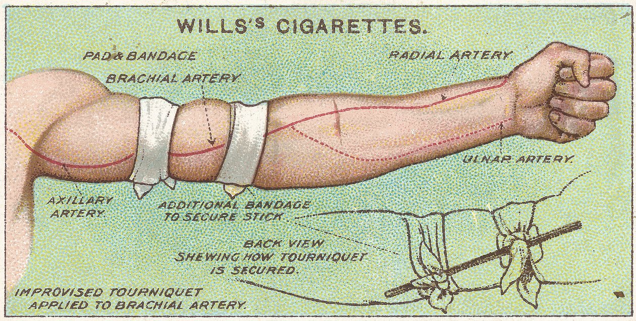 Tourniquet，1913年来自Willss Cigarettes卡的First Aid系列的11号 作者 英语学校