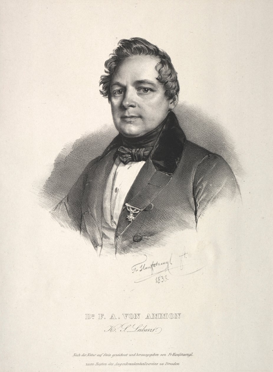博士弗里德里希·奥古斯特·冯·阿蒙（Friedrich August von Ammon），1838年。 作者 弗朗茨·塞拉夫·汉夫斯坦格尔