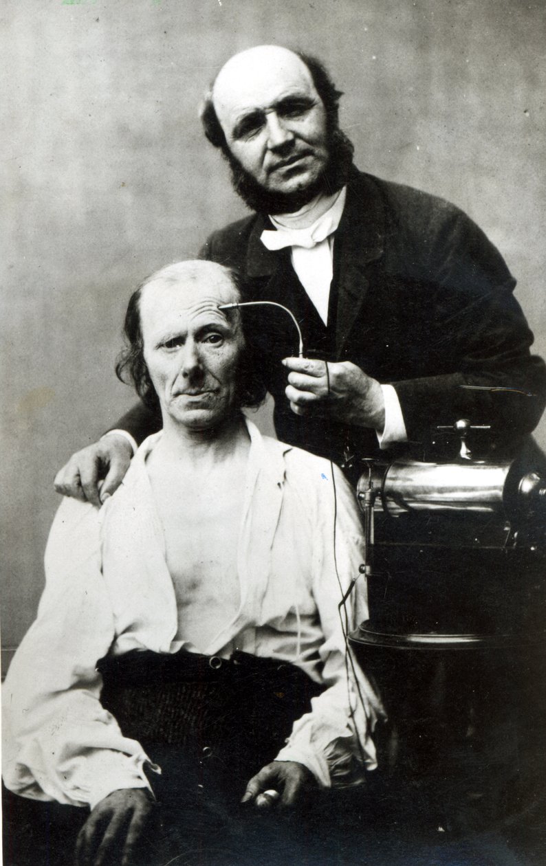 Duchenne de Boulogne与受害者患者，1862年 作者 法国摄影师
