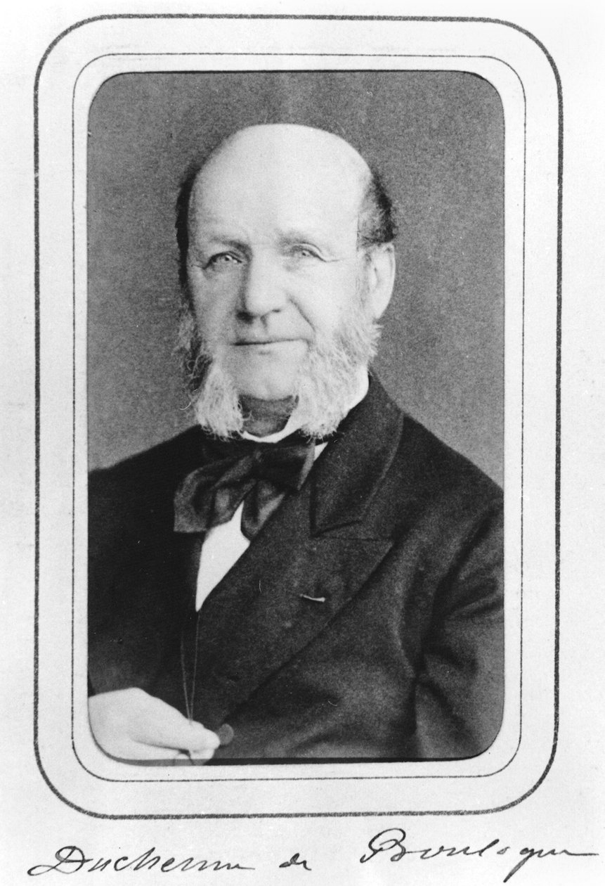 布洛涅的William Benjamin Duchenne（1806-75） 作者 法国摄影师