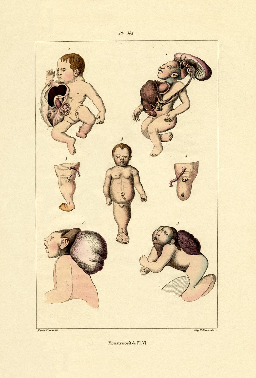 怪胎，1833-39 作者 法语学校