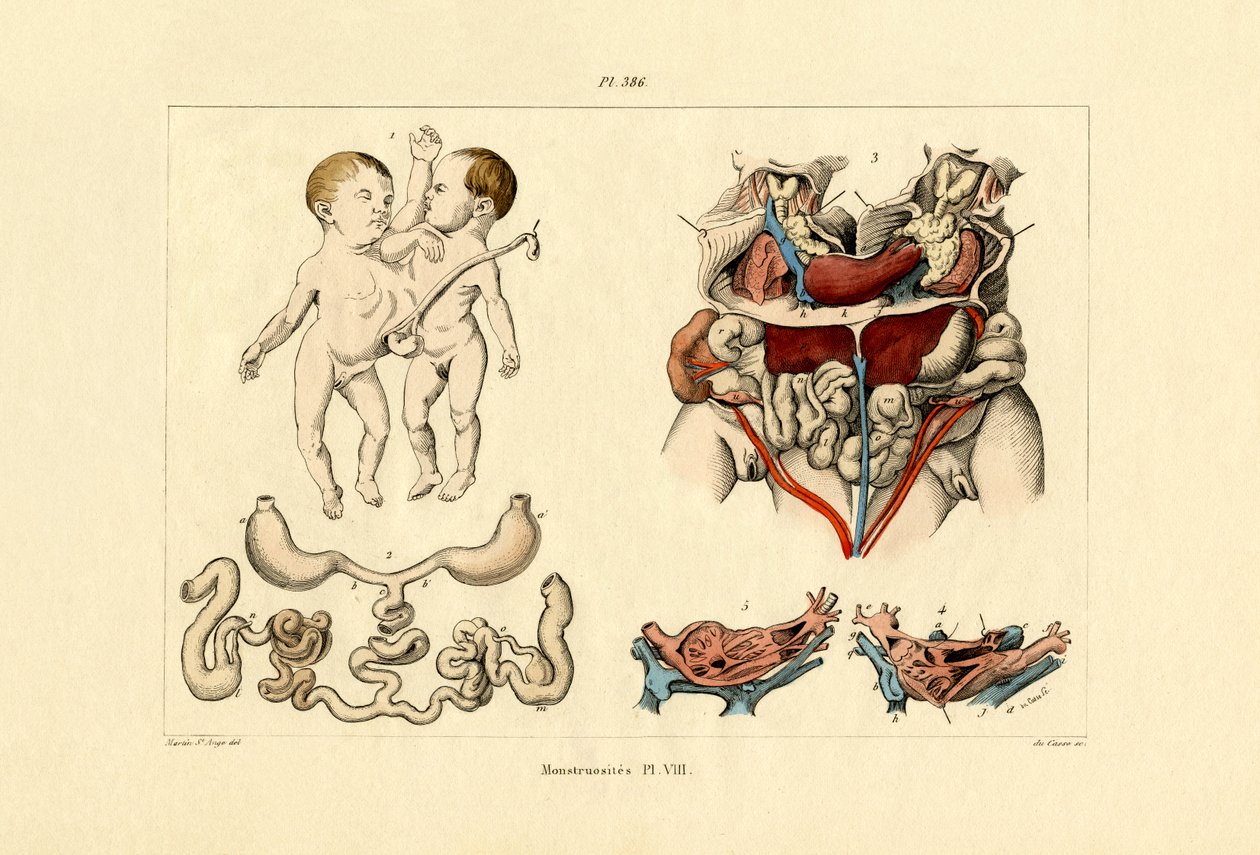 怪胎，1833-39 作者 法语学校