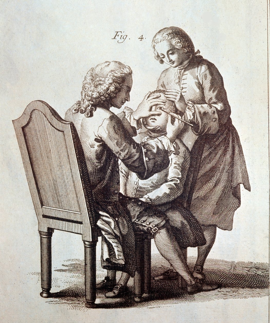 医生为白内障患者做手术，插图选自 Denis Diderot 和 Jean le Rond d