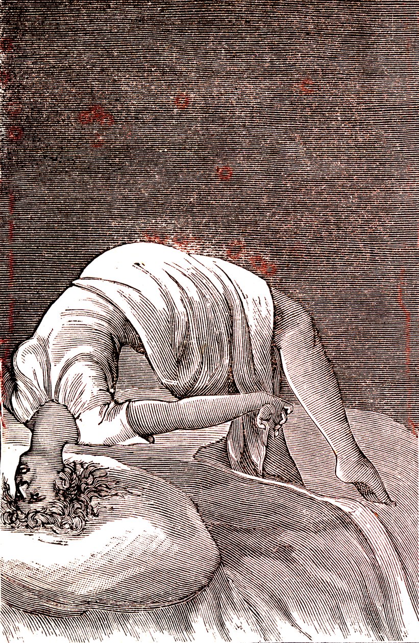 癔病，因强烈焦虑而导致的精神和神经失调。1887年（雕刻） 作者 法语学校