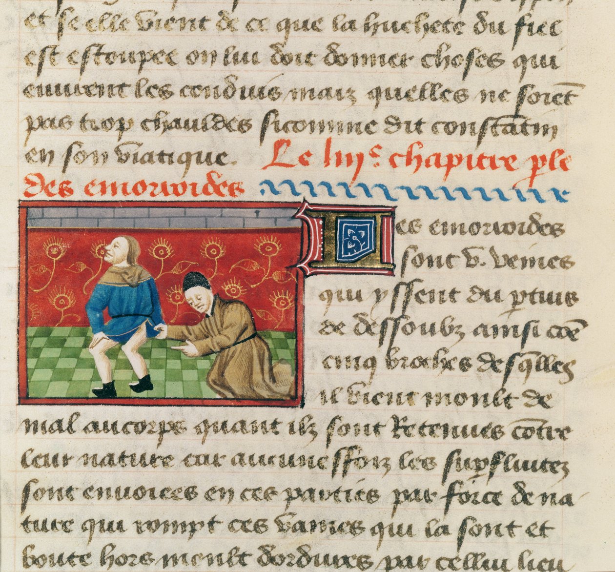 22532女士对痔疮患者的检查，来自Barthelemy English的“物联”，c。 1410年至1415年 作者 法语学校