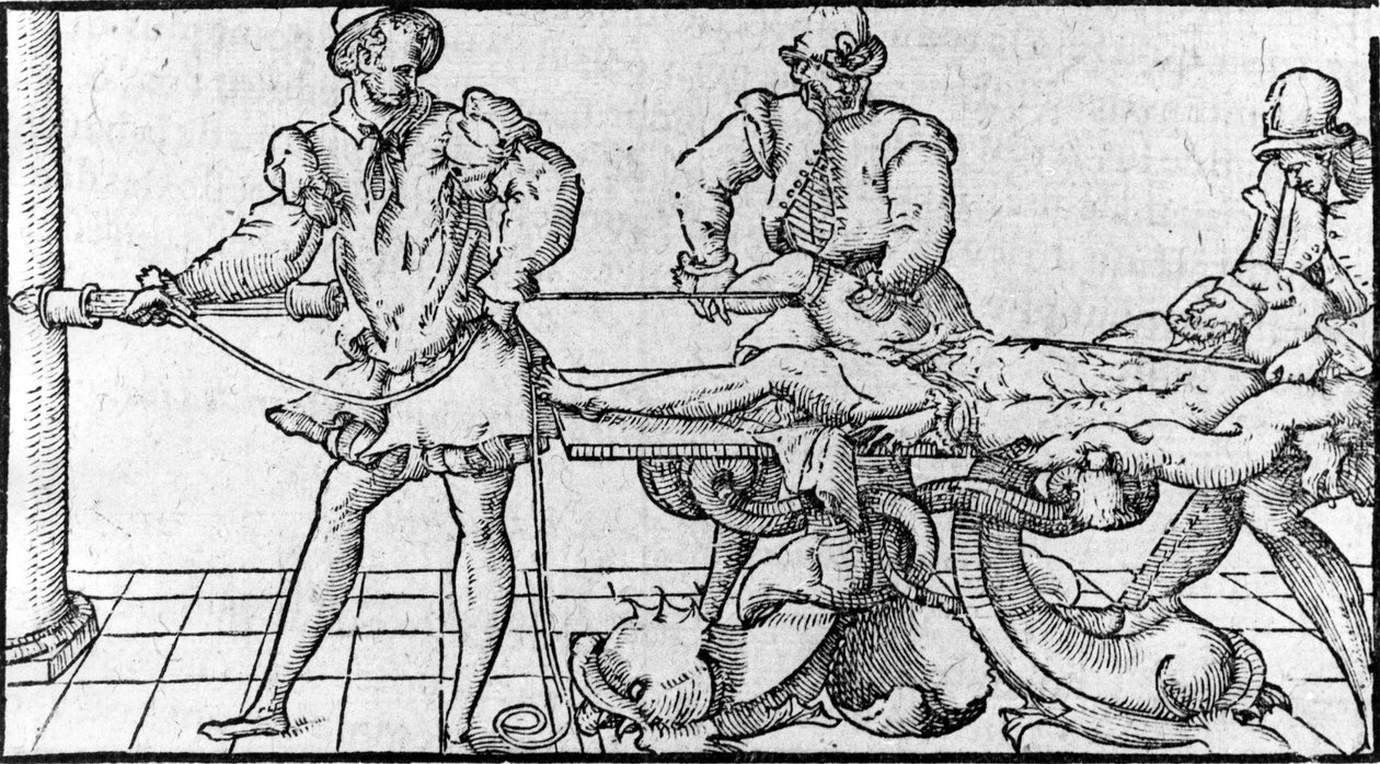 缩小脱臼，载于《安布罗伊斯-帕尔的医学指南》，约1560年。 作者 法语学校
