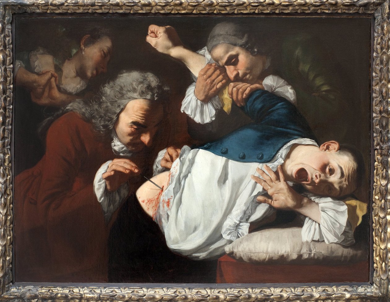 Operation. Painting by Gaspare Traversi (ca. 1722-1770), oil on canvas, ca. 1753-1754. Italian art 18th century. Staatsgalerie Stuttgart (Germany). 作者 加斯佩·特拉沃西