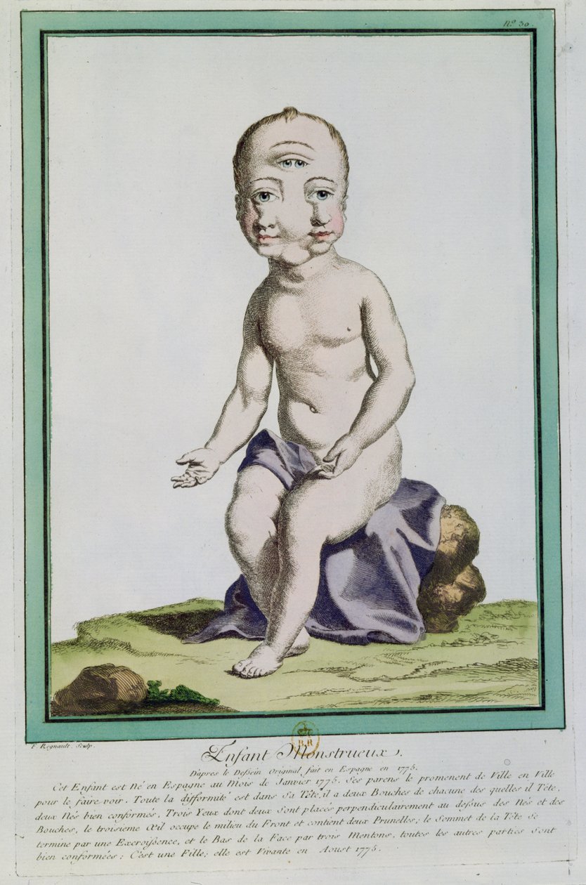 1775年，来自巴黎的&39;Les Ecarts de la Nature&39;的变形头的孩子 作者 Genevieve Regnault de Nangis