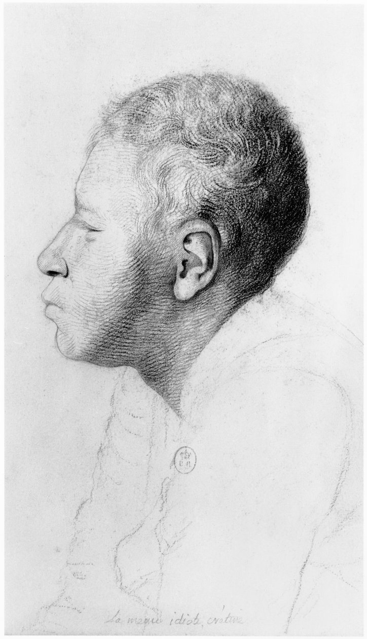 Cretin，简介，插图来自Jean Etienne Dominique Esquirol（1772-1840）未发表论文关于Salpetriere庇护的疯子，第1818页 作者 乔治·弗朗索瓦·加布里埃尔