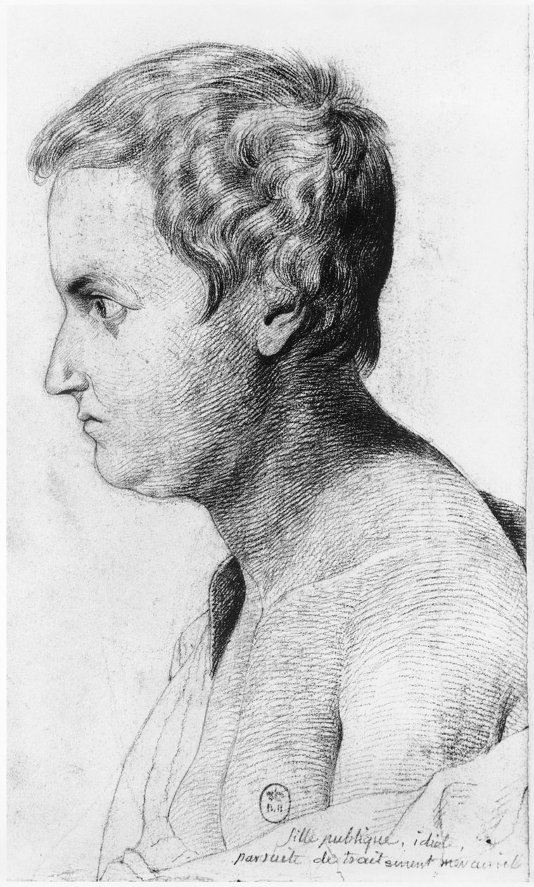 患有梅毒的白痴妓女，来自Jean Etienne Dominique Esquirol（1772-1840）关于Salpetriere庇护的疯子的未发表论文的插图，c.1818 作者 乔治·弗朗索瓦·加布里埃尔