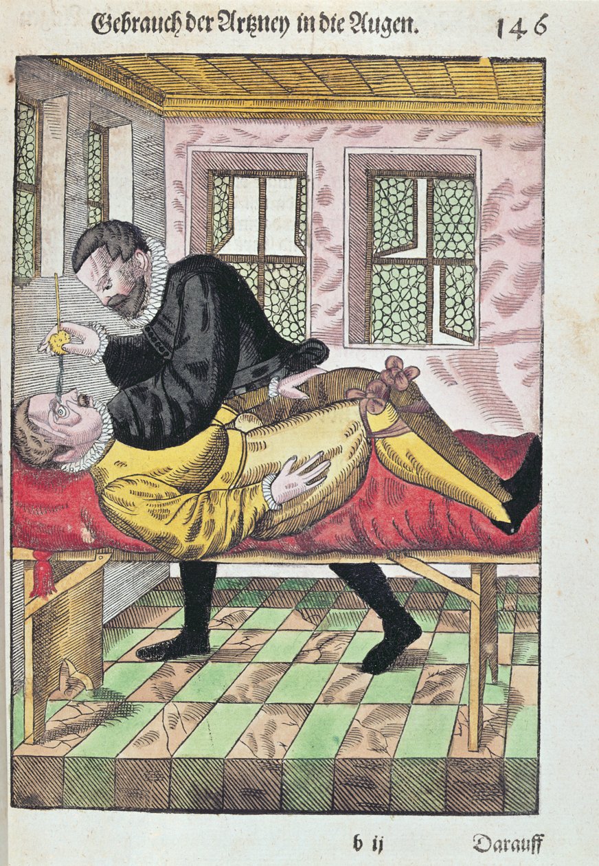 眼科手术，来自Ophthalmodouleia的Georg Bartisch（1535-1636）于1583年在德累斯顿出版（彩色木版画） 作者 德国学校