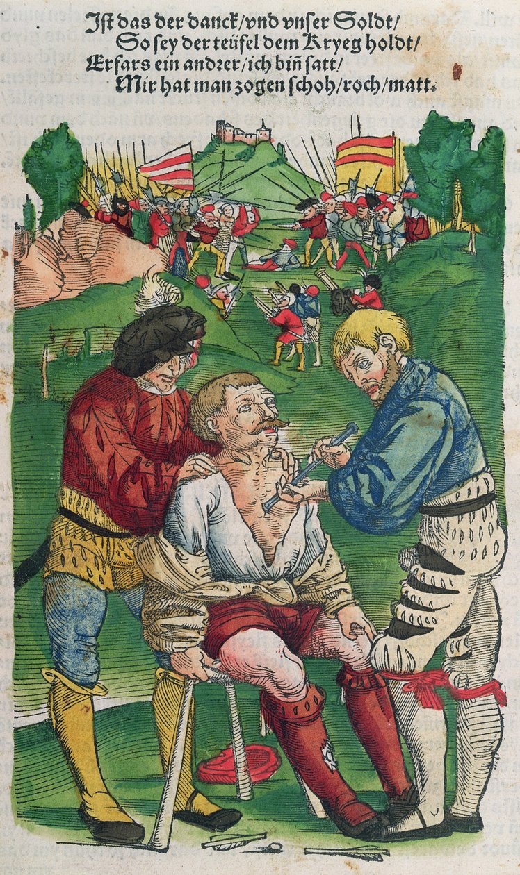 删除箭头，插图来自Feldtbuch der Wundartzney，Hans von Gersdorff，1540 作者 德国学校