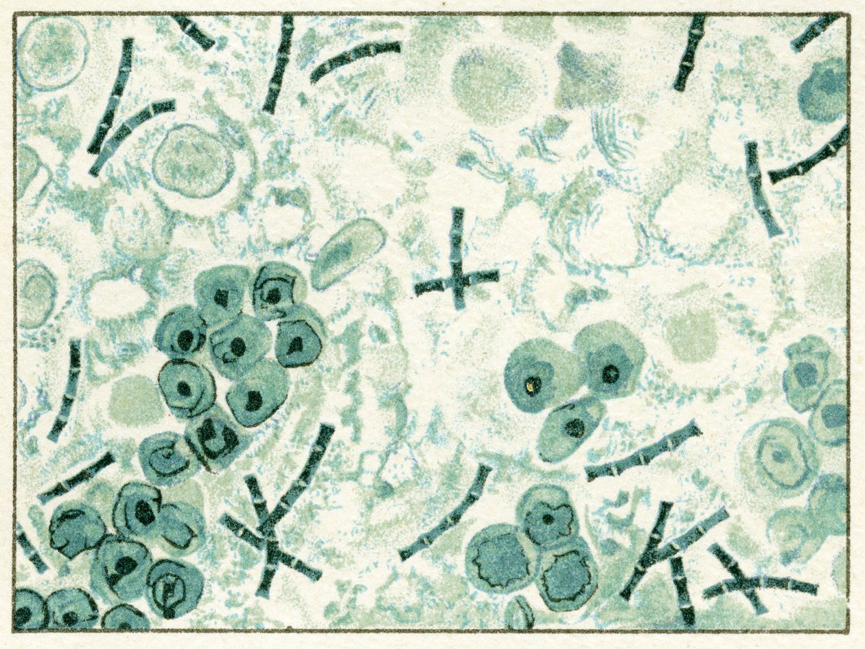 血液中的炭疽细菌样本c.1890（彩色石版画） 作者 德国学校