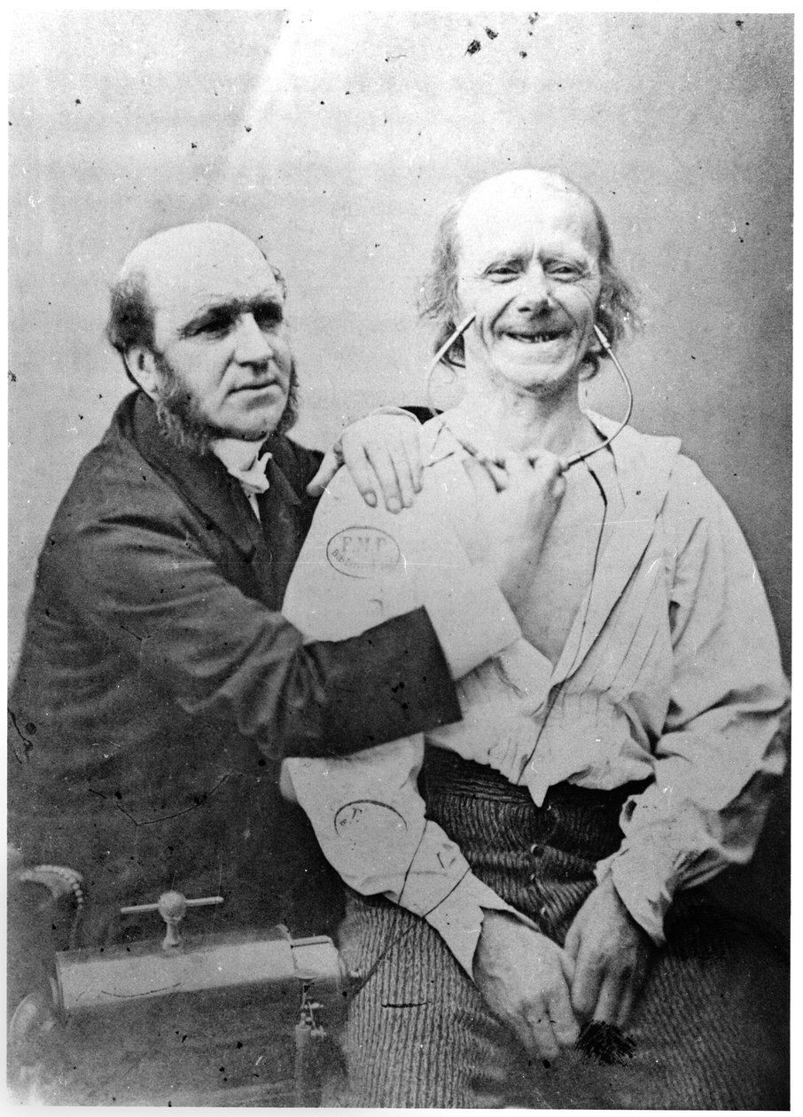 法兰西于1876年出版的“Duchenne de Boulogne的人体相貌机制或电生理分析” 作者 纪尧姆·本杰明·阿曼德·杜兴·德·布洛涅