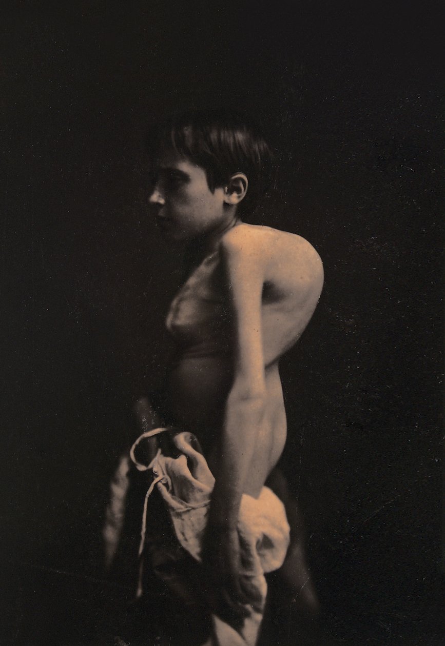 驼背男孩的肖像，c.1855-57 作者 纪尧姆·本杰明·阿曼德·杜兴·德·布洛涅