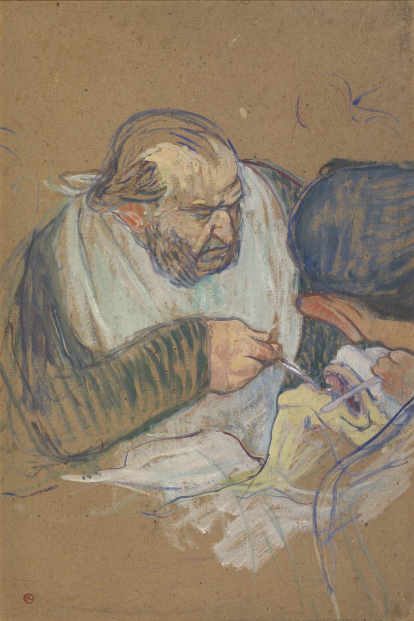佩恩博士（PéanOperating），1891-92年 作者 亨利·德·图卢兹·劳特雷克