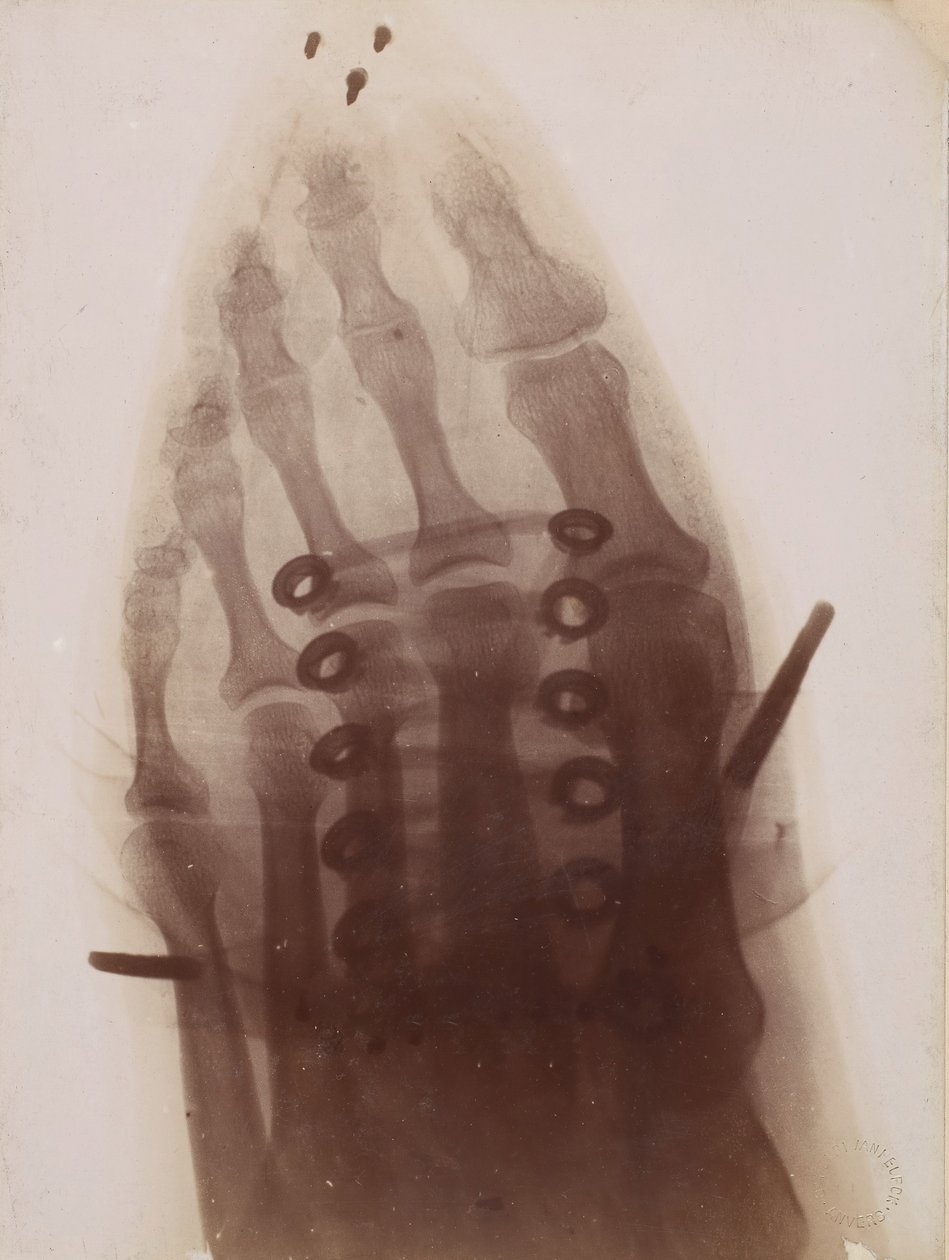 穿过鞋子的脚，1896年。 作者 亨利·凡·赫克