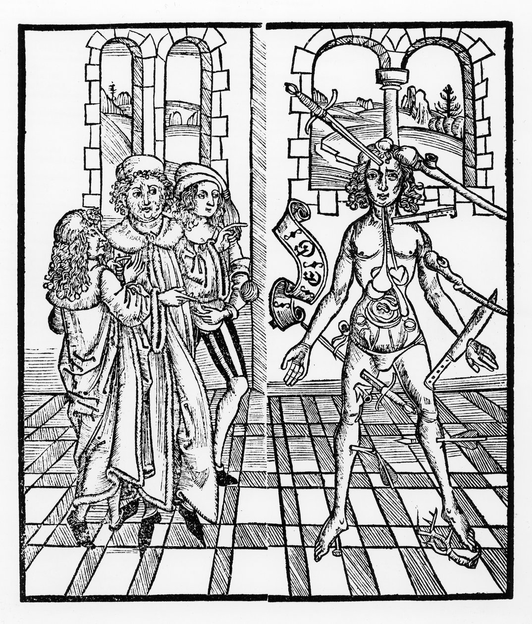 1497年，斯特拉斯堡的“受伤的人”出版于斯特拉斯堡 作者 Hieronymus Brunschwig