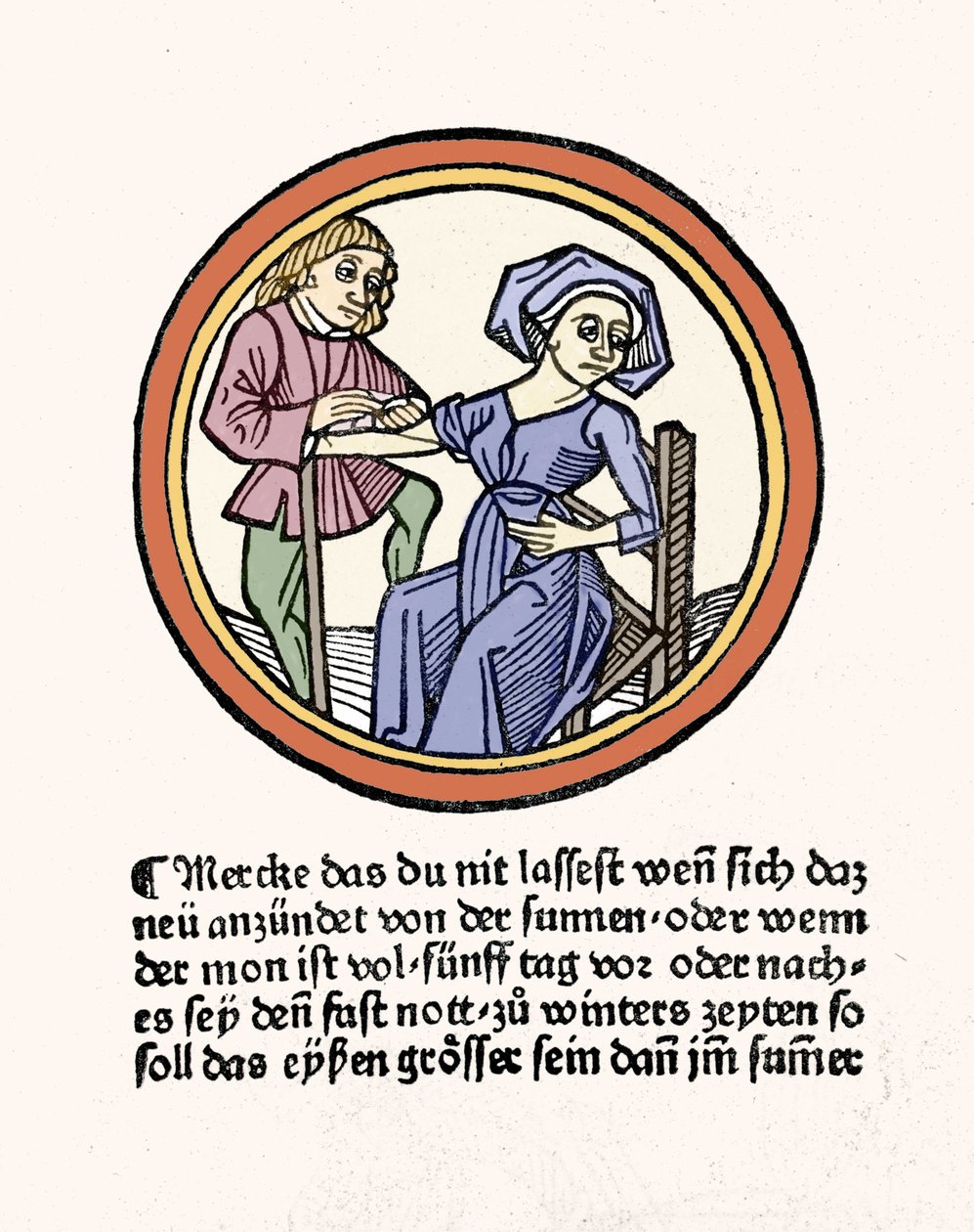 一个女人的出血。Xylography取自Hyeronimus Braunschweig的 "Buch de Surgery"。斯特拉斯堡1497年 作者 Hieronymus Brunschwig