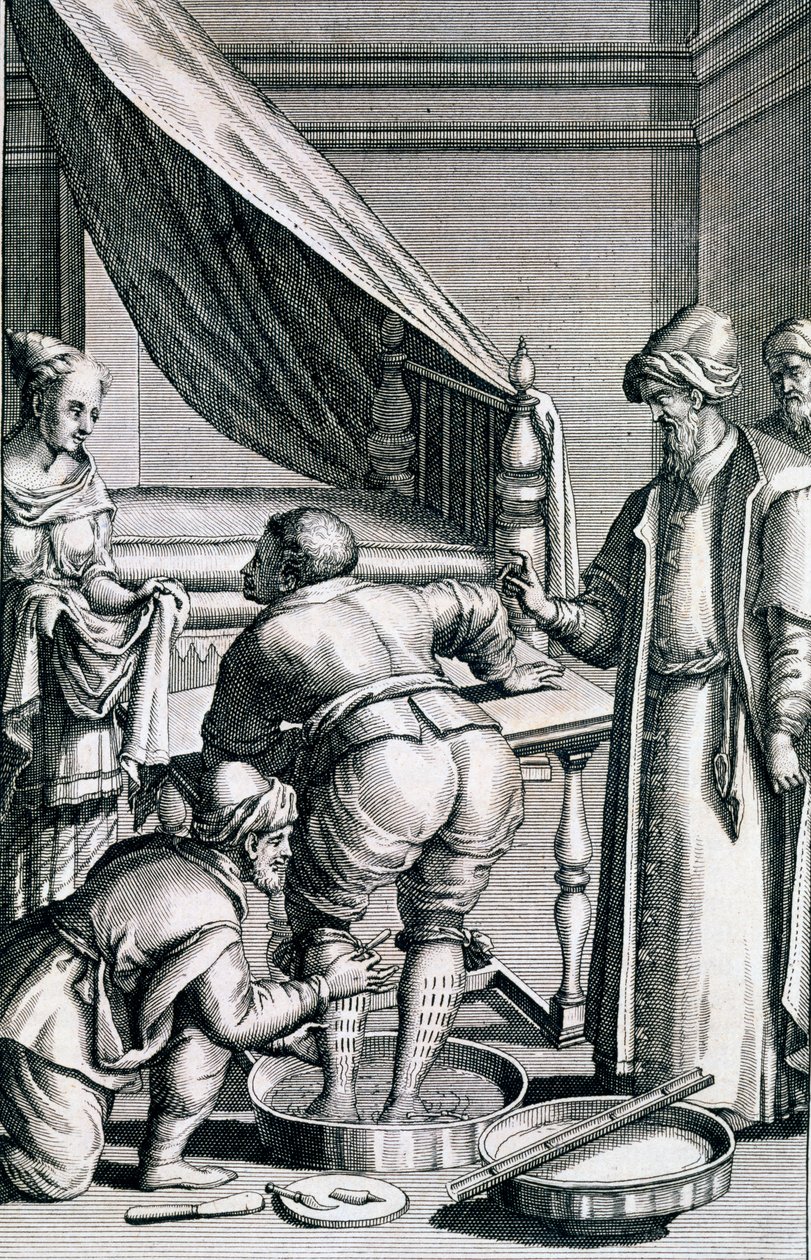 腿部放血，来自Prospero Alpini的Medicina Aegyptiorum，于1745年出版 作者 意大利学校