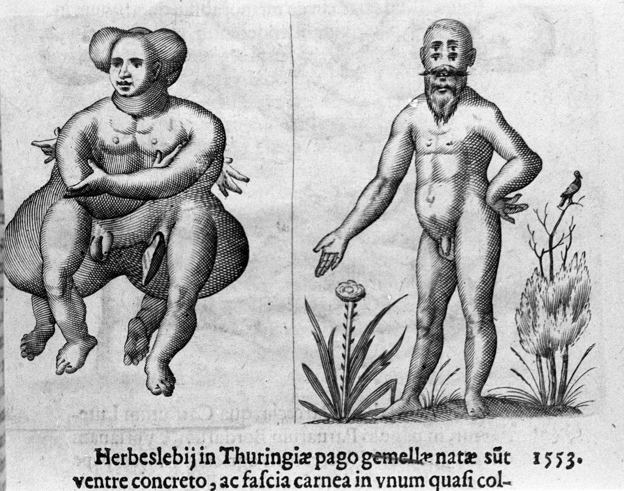 不同类型的人类怪物。 雕刻意大利科学家 Fortunio Liceti（1577-1656）的“怪物性质、原因和差异”。 1646 作者 意大利学校