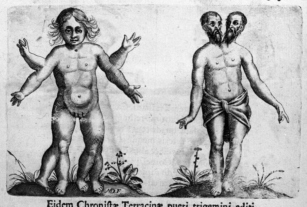 不同类型的人类怪物 由意大利科学家 Fortunio Liceti (1577-1656) 雕刻“怪物的性质、原因和差异”。 1646 作者 意大利学校