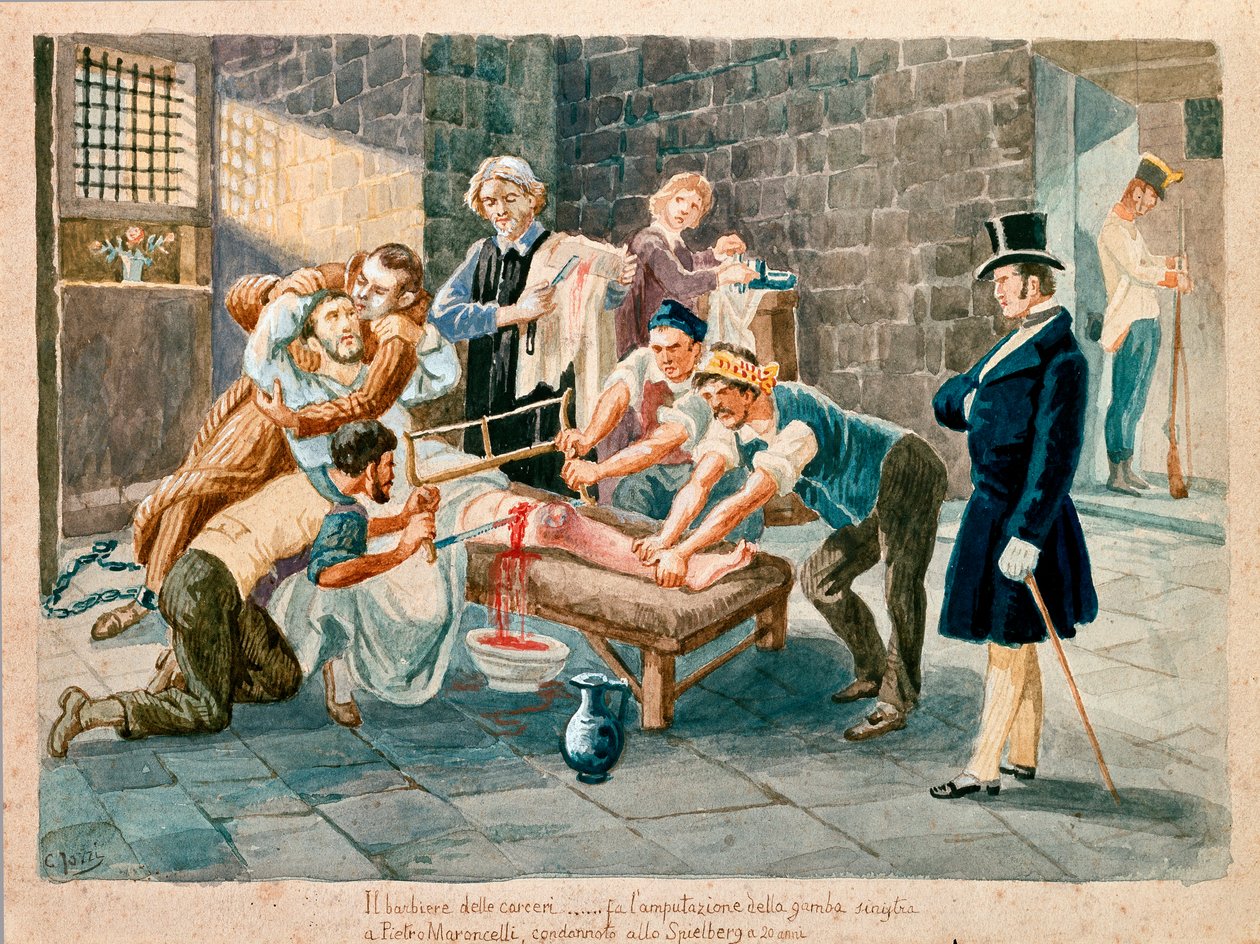 爱国者和 Carboneria (Carbonarism) 成员 Pietro Maroncelli (1795-1846) 在被监禁在摩拉维亚的斯皮尔伯格堡垒的忏悔者期间被截肢。 19 世纪 Museo del Risorgimento 的版画，米兰 作者 意大利学校