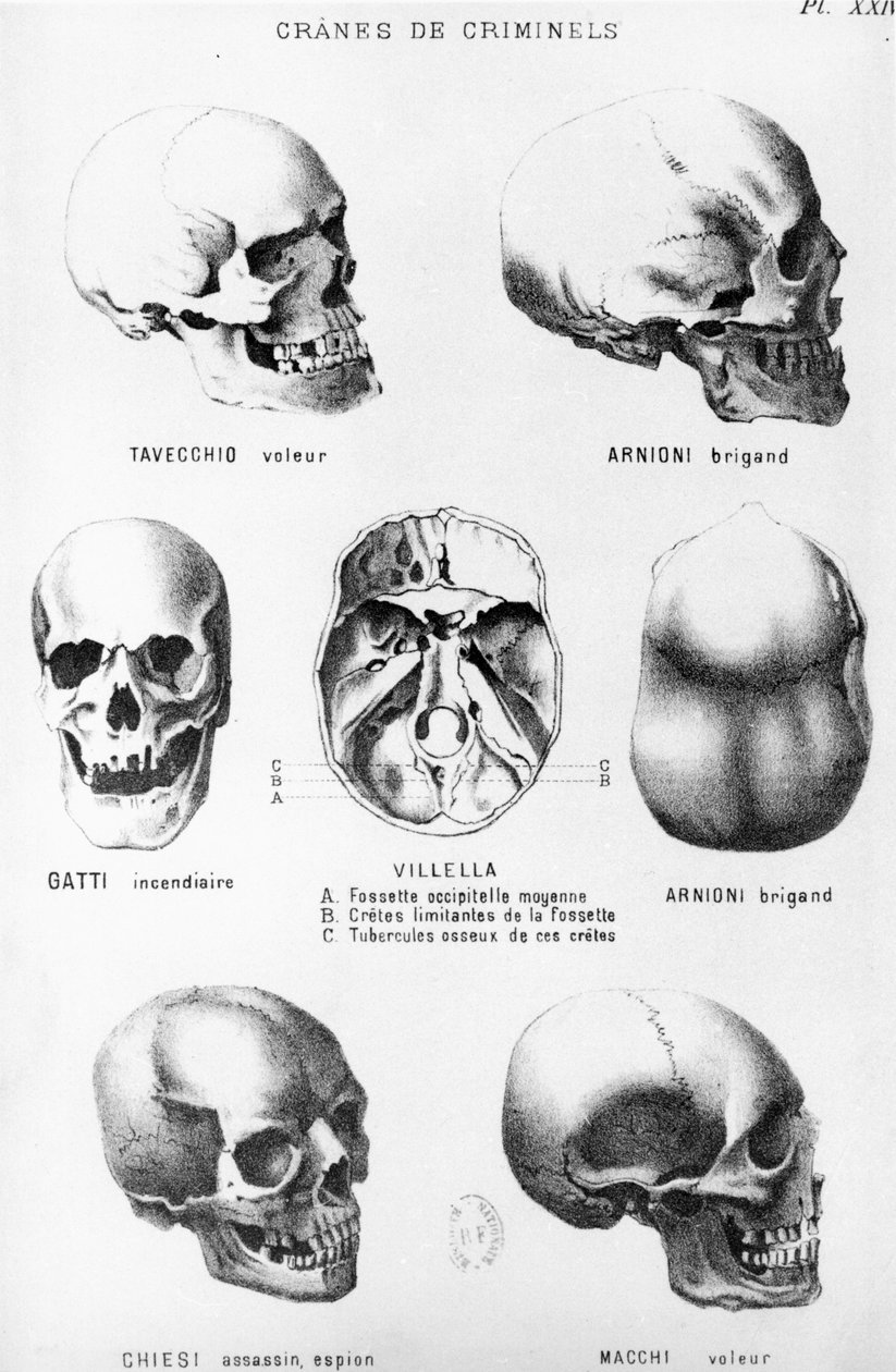 凶手的头骨，来自Cesare Lombroso的LHomme Criminel（1835-1909），由Felix Alcan出版，1887年 作者 意大利学校