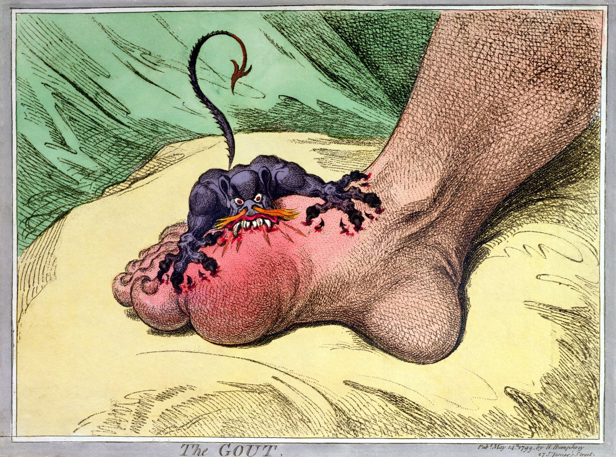 痛风，由Hannah Humphrey于1799年出版（手工彩色软底蚀刻） 作者 詹姆斯·吉里