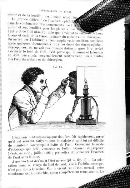 来自 "Traite Pratique des Maladies des Yeux "的插图，这是托马斯-沃顿-琼斯（1808-91）翻译的《眼科医学和外科原理与实践手册》，由E. Foucher翻译，1862年在巴黎出版（雕刻）（b/w照片） 作者 让·弗朗索瓦·巴杜罗