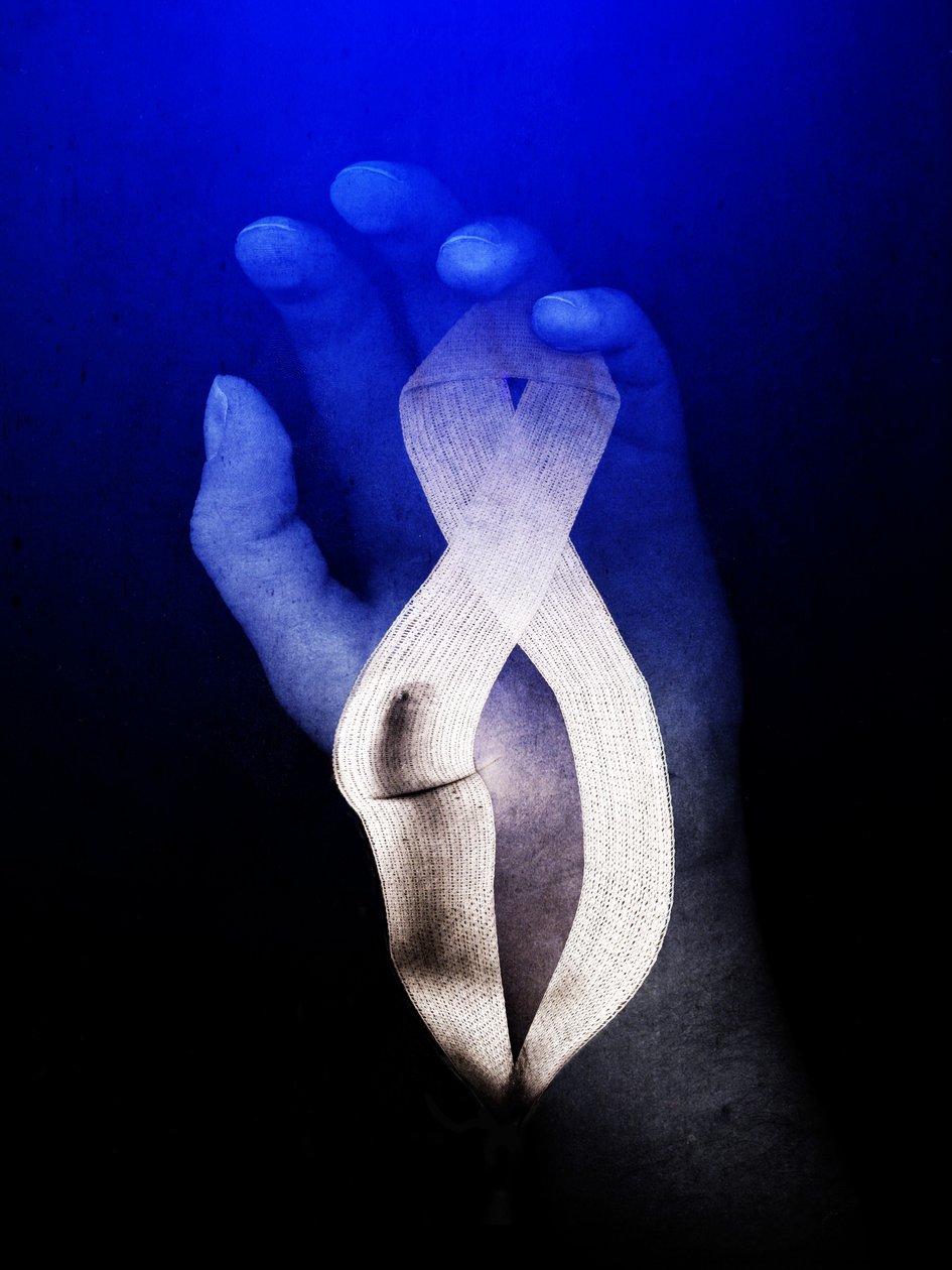 乳腺癌，2013 年（摄影） 作者 约翰·利利亚（Johan Lilja）