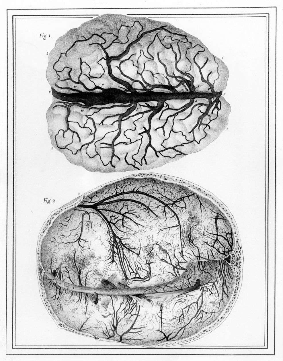 大脑，1825年 作者 朱尔斯·格曼（Jules Germain）Cloquet